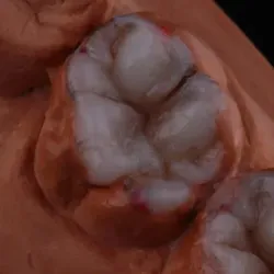 Курс моделирования зубов для стоматологов