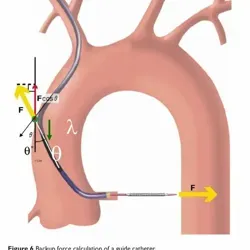 TIS: tips in science. Interventional